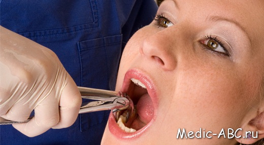 Может ли болеть десна после удаления зуба?