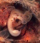 Медикаментозный аборт сроки фото