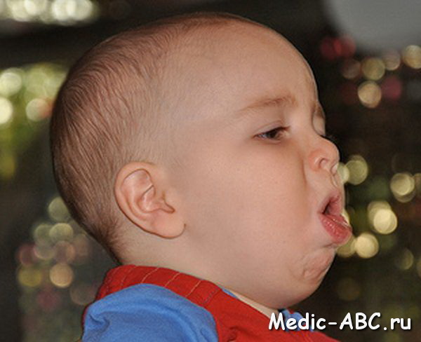 Чем лечить детский кашель