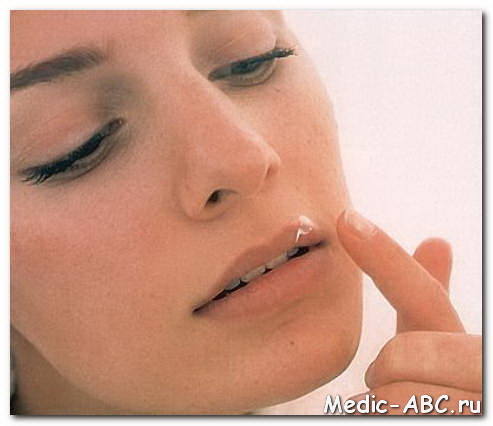 Как лечить герпес во рту