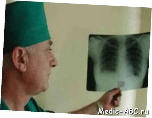 Как лечить туберкулез
