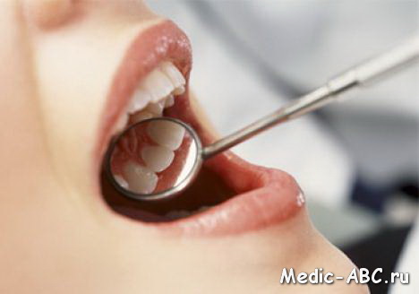 Симптомы и лечение грибковых заболеваний полости рта
