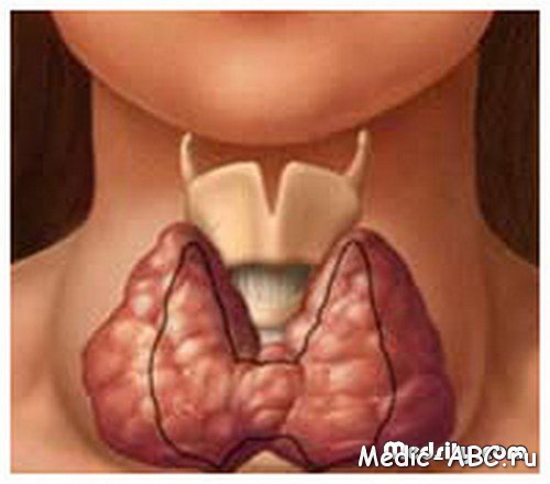 Симптомы щитовидной